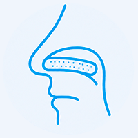 Epistaxe – tamponamento anterior / antero-posterior