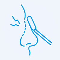 Tratamento de deformidade traumática nasal